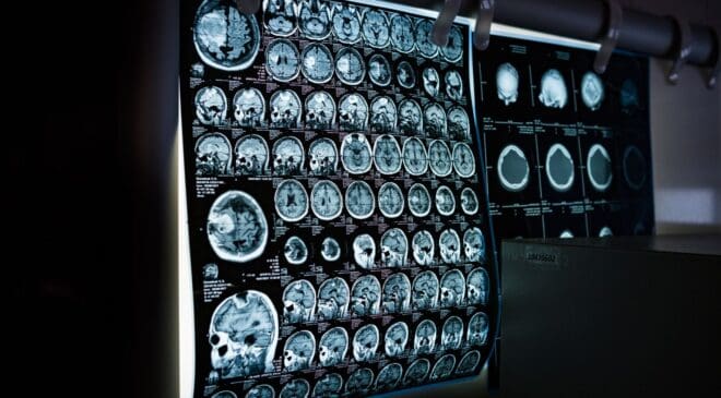 Mice made a “memory switch” look easy: a hidden brain circuit just changed the rules 44 hidden brain circuit